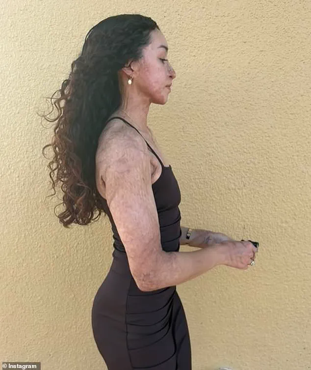 Late-Breaking: Shooting Shatters Aspiring Bodybuilder's Dreams Two Weeks Before Debut Show