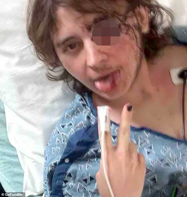 Alleged ICE Projectile Strike Leaves College Student at Risk of Permanent Vision Loss, Sparking Concerns Over Protester Safety