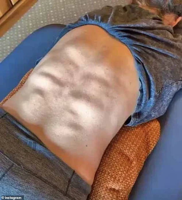 Mikaela Shiffrin's Social Media Post Reveals Back Muscles, Showcasing Alpine Skiing's Physical Demands