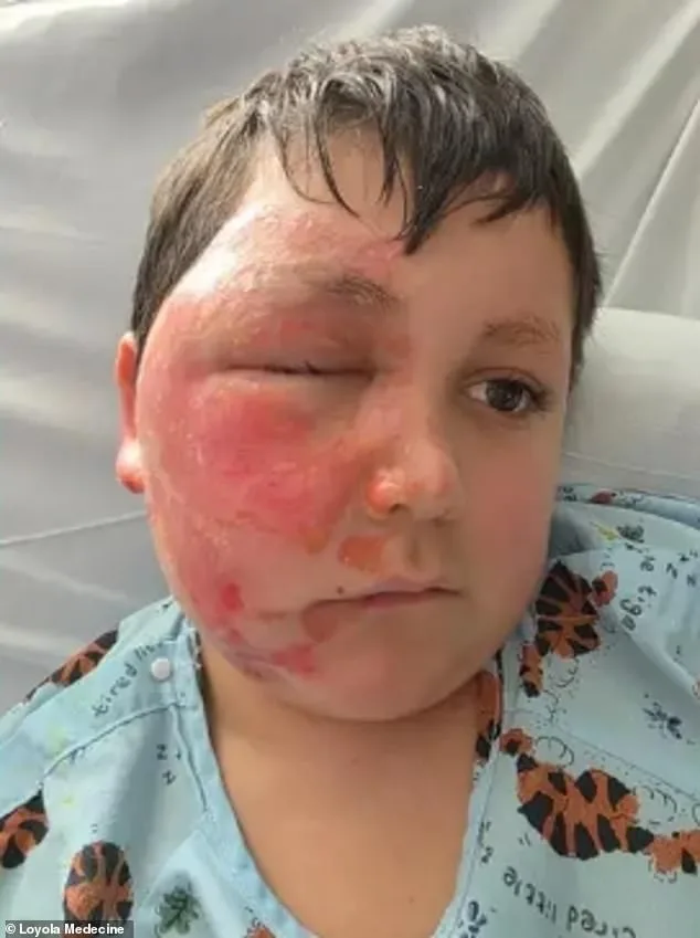 14-Year-Old Girl Left in Critical Condition After Viral TikTok 'Fire-Breathing' Challenge
