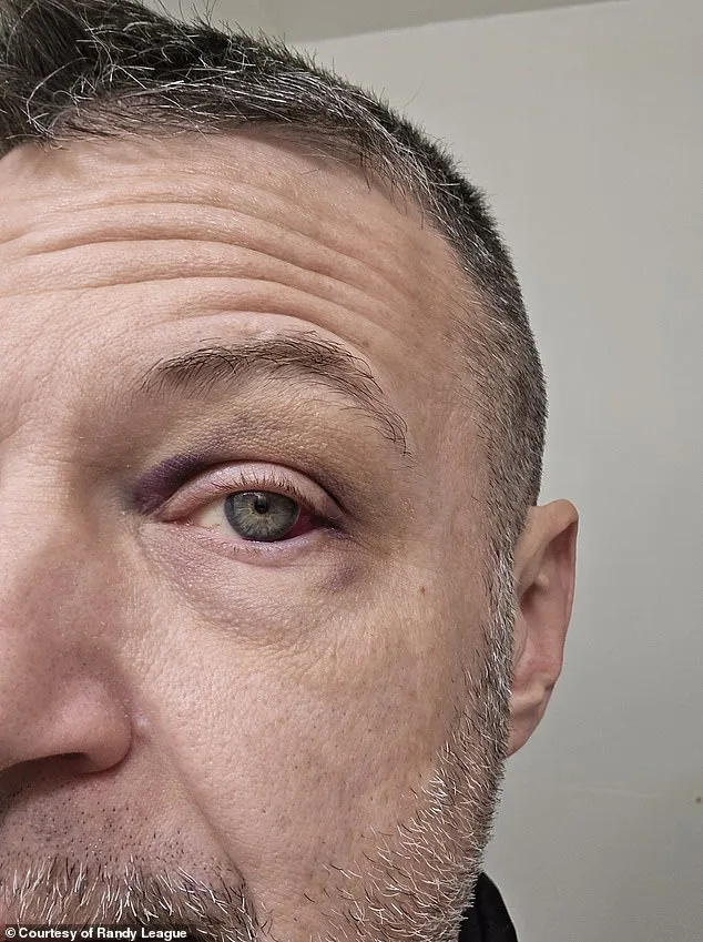 Mysterious Eye Injury Leaves Man Blinded