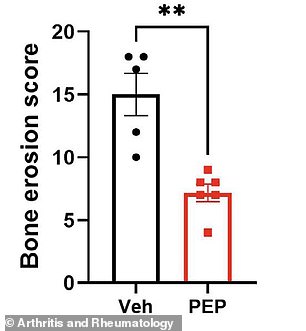 New peptide PEPITEM treats arthritis by blocking inflammation without severe side effects.