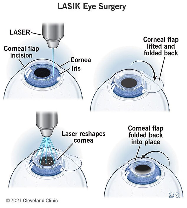 Laser eye surgery ruined Briana Coria's life with hidden side effects.